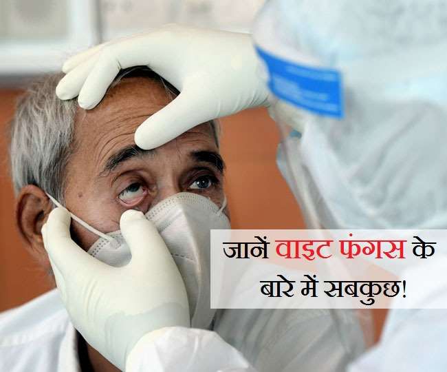 भारत में 'वाइट फंगस' संक्रमण से कड़ी हो रही हैं नई स्वास्थ्य चिंताएं