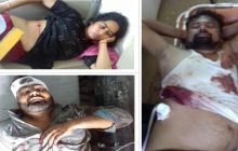 पूर्व बीडीसी सदस्य और पत्नी को बदमाशों ने मारी गोली, आरोपी को ग्रामीणों ने पीट- पीटकर किया अधमरा