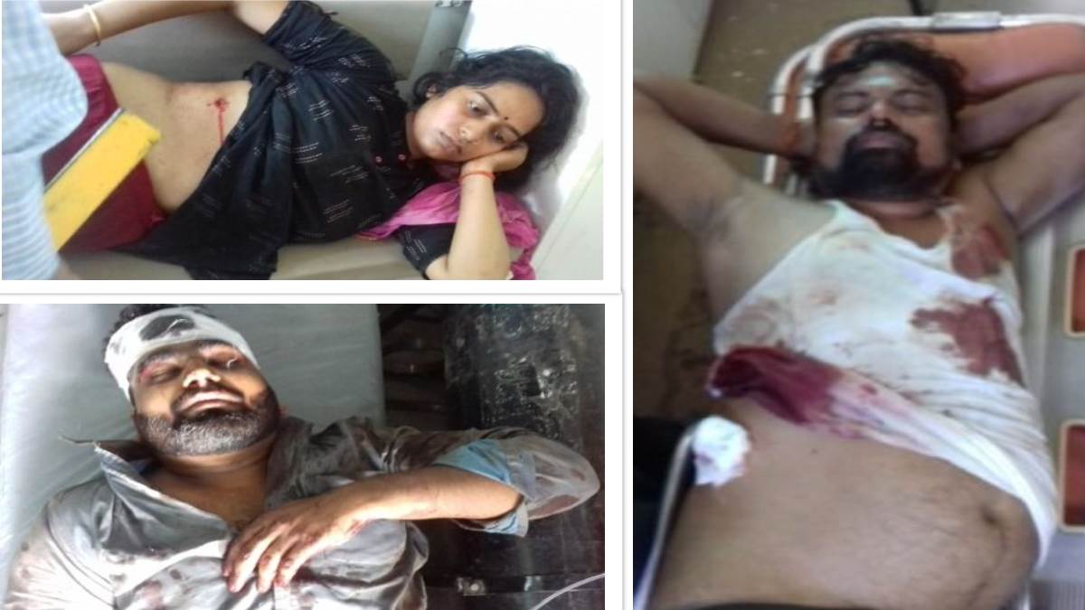 पूर्व बीडीसी सदस्य और पत्नी को बदमाशों ने मारी गोली, आरोपी को ग्रामीणों ने पीट- पीटकर किया अधमरा