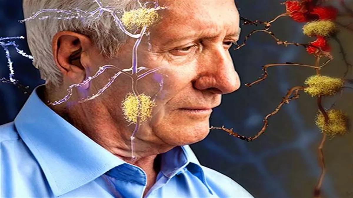 अल्जाइमर से बचाते हैं ये फूड्स, अल्जाइमर के मरीज रोजाना करें सेवन